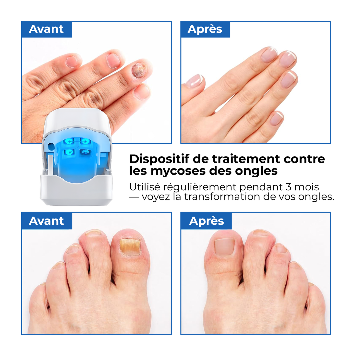 FungaLite Restore™