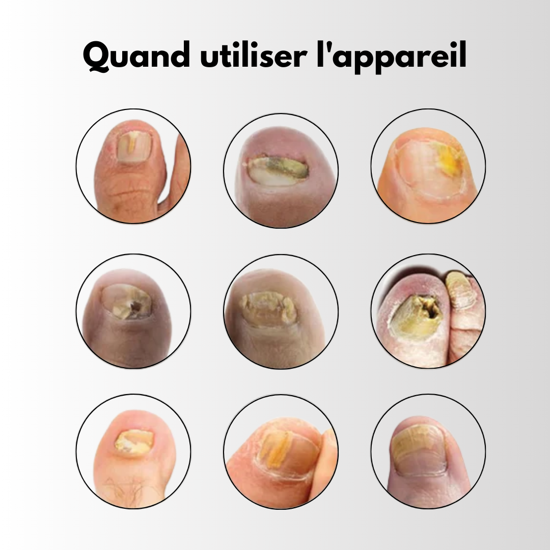 FungaLite Restore™