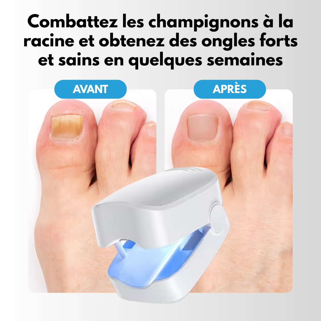 FungaLite Restore™